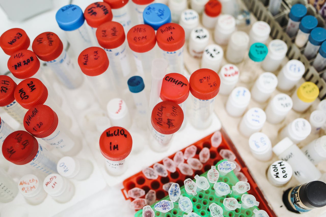 Lab test tubes and bottles with colorful caps and labels seen from above in a scientific setting.