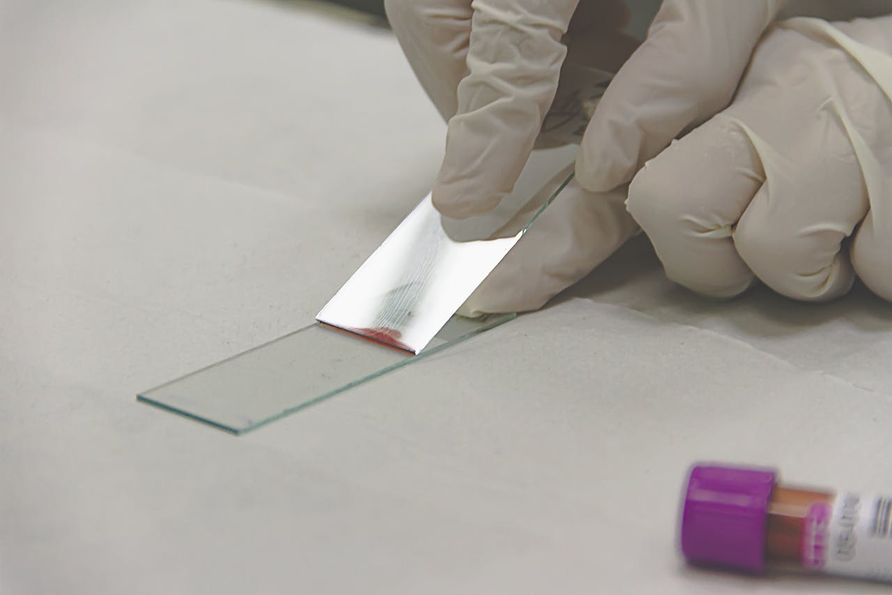 Scientist in gloves preparing a glass slide with a sample for microscopic analysis.
